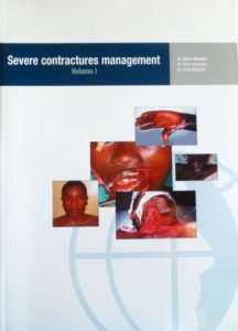 Severe Contractures Management. Vol I 