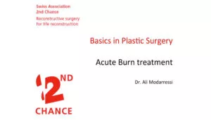 Acute burn treatment | Basics in Plastic Surgery – Dr. Ali MODARRESSI