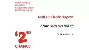 Acute burn treatment | Basics in Plastic Surgery – Dr. Ali MODARRESSI