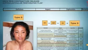 Neck Contracture-Supraclavicular Perforator