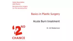 Acute burn treatment | Basics in Plastic Surgery - Dr. Ali MODARRESSI