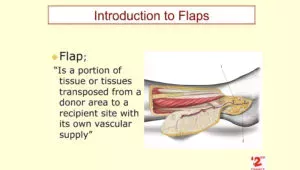 105 - Introduction to Flaps surgery - Dr Alberto MUSOLAS