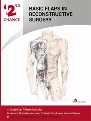 Basic Flaps in Reconstructive Surgery